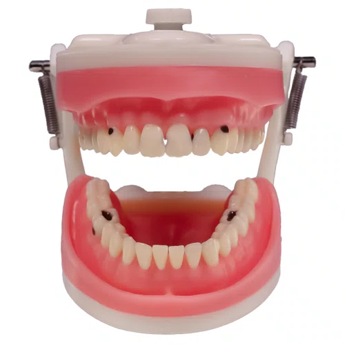 Dentes Cariados (MDT044) - Pronew/Prodens