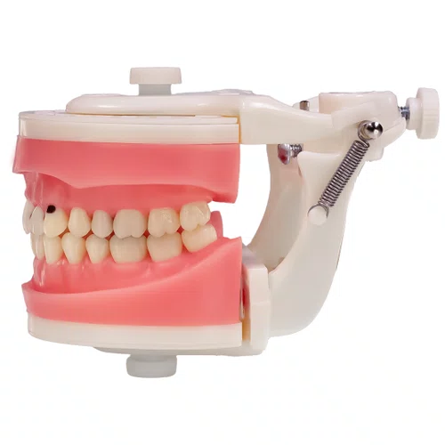 Dentes Cariados (MDT044) - Pronew/Prodens