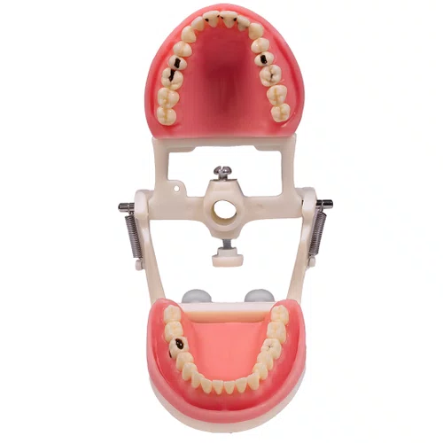 Jogo de Dentes Cariados (MDT074/4092) - Pronew/Prodens