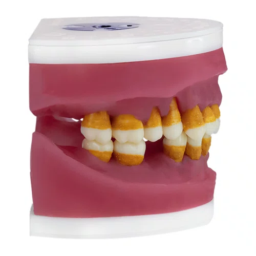 Manequim Refil de Cirurgia com Dente de Perio (AC025) - Pronew/Prodens