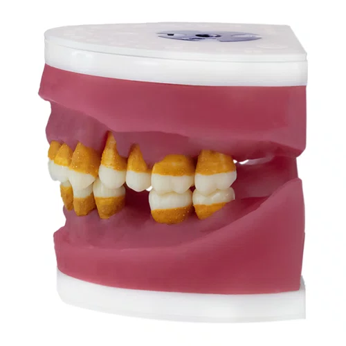 Manequim Refil de Cirurgia com Dente de Perio (AC025) - Pronew/Prodens