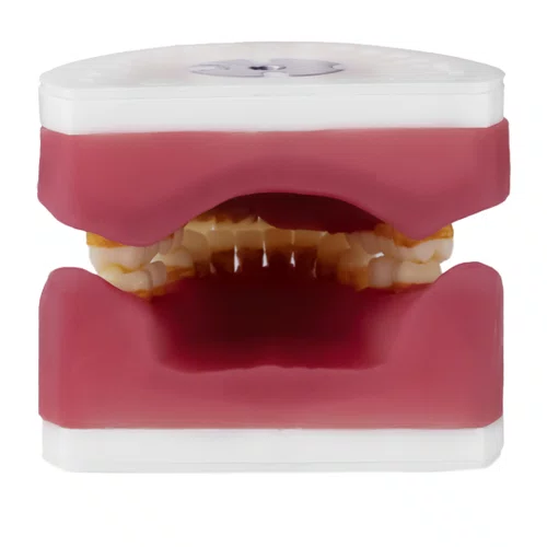 Manequim Refil de Cirurgia com Dente de Perio (AC025) - Pronew/Prodens