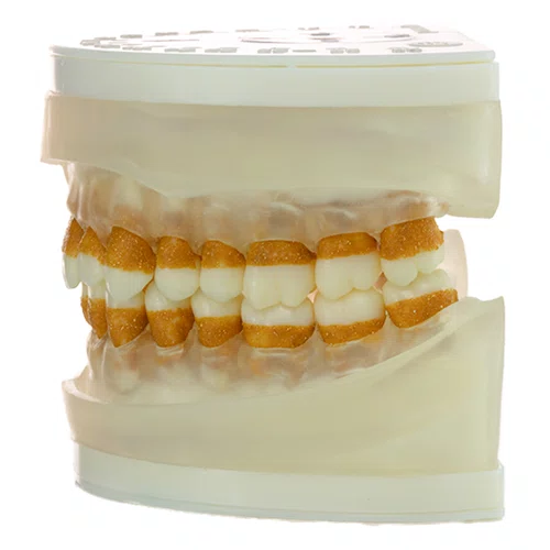 Refil para Periodontia I (AC104) - Pronew/Prodens