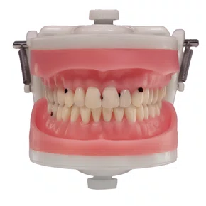 Dentes Cariados (MDT044) - Pronew/Prodens