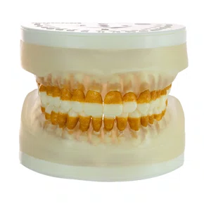 Refil para Periodontia I (AC104) - Pronew/Prodens