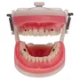 Dentes Cariados (MDT044) - Pronew/Prodens