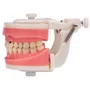 Dentes Cariados (MDT044) - Pronew/Prodens