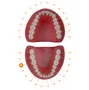 Dente I Oclusal Cariado 46.6 - Prodens