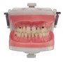 Jogo de Dentes Cariados (MDT074/4092) - Pronew/Prodens