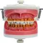 Manequim para Cirurgia com Dentes de Periodontia (PD110) - Pronew/Prodens