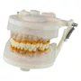 Manequim de Periodontia II (PD103) - Pronew/Prodens