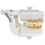 Manequim de Periodontia II (PD103) - Pronew/Prodens