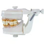 Manequim de Periodontia II (PD103) - Pronew/Prodens