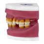 Manequim Refil de Cirurgia com Dente de Perio (AC025) - Pronew/Prodens