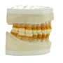 Refil para Periodontia I (AC104) - Pronew/Prodens